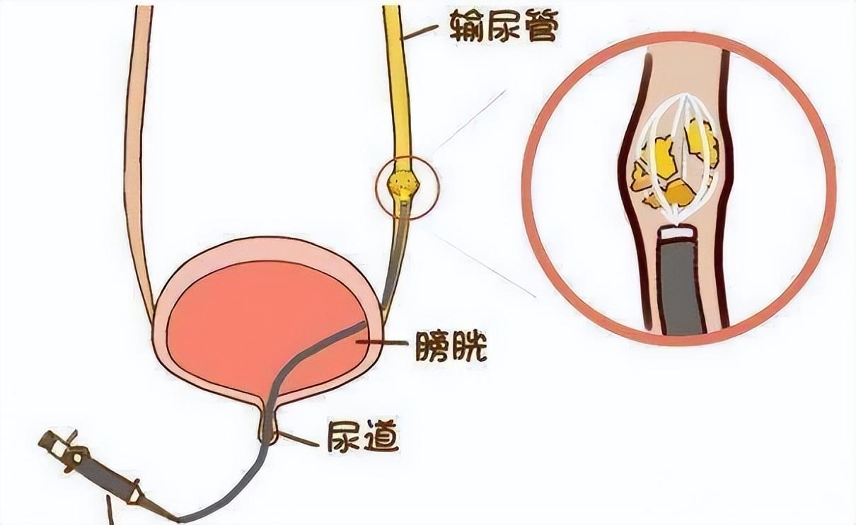 排3开机号与试机号的奥秘，近10期数据分析排3开机号和试 机号最近30期查询